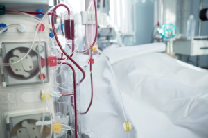 Advanced dialysis machine and dialysis equipment for renal care