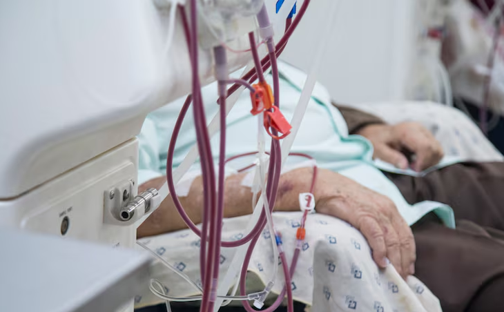 Dialysis Equipment and Devices: A Complete Overview